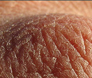 Zoomed In A piece of skin Knuckle 